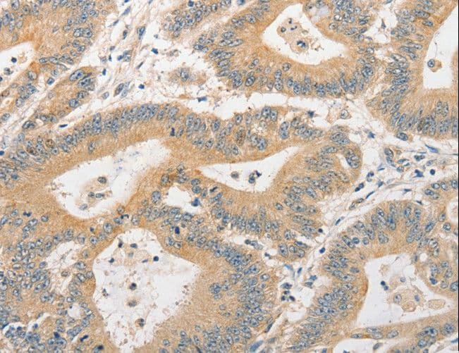 BCL2L14 / BCL-G Antibody