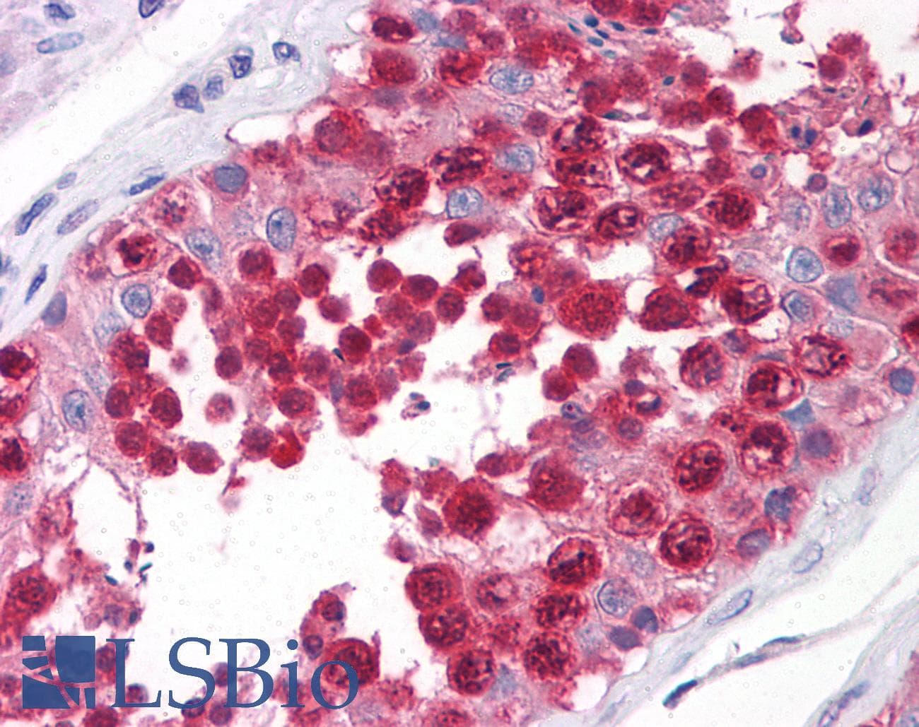 IHC-plus™ Monoclonal Mouse anti-Human CSE1L Antibody (clone 3F8, IHC, IF, WB)