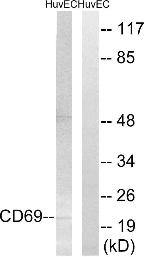CD69 Antibody