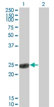 COMT Antibody (clone 1G4-1A1)