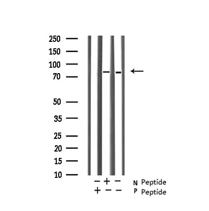 NR3C1/Glucocorticoid Receptor Antibody (phospho-Ser203)