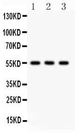 PLTP Antibody (aa256-271)