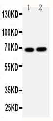 LMNB2 / Lamin B2 Antibody (aa580-597)