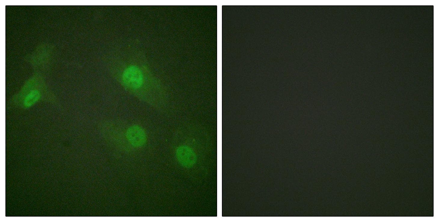 NFKB1 / NF-Kappa-B Antibody (phospho-Ser927)