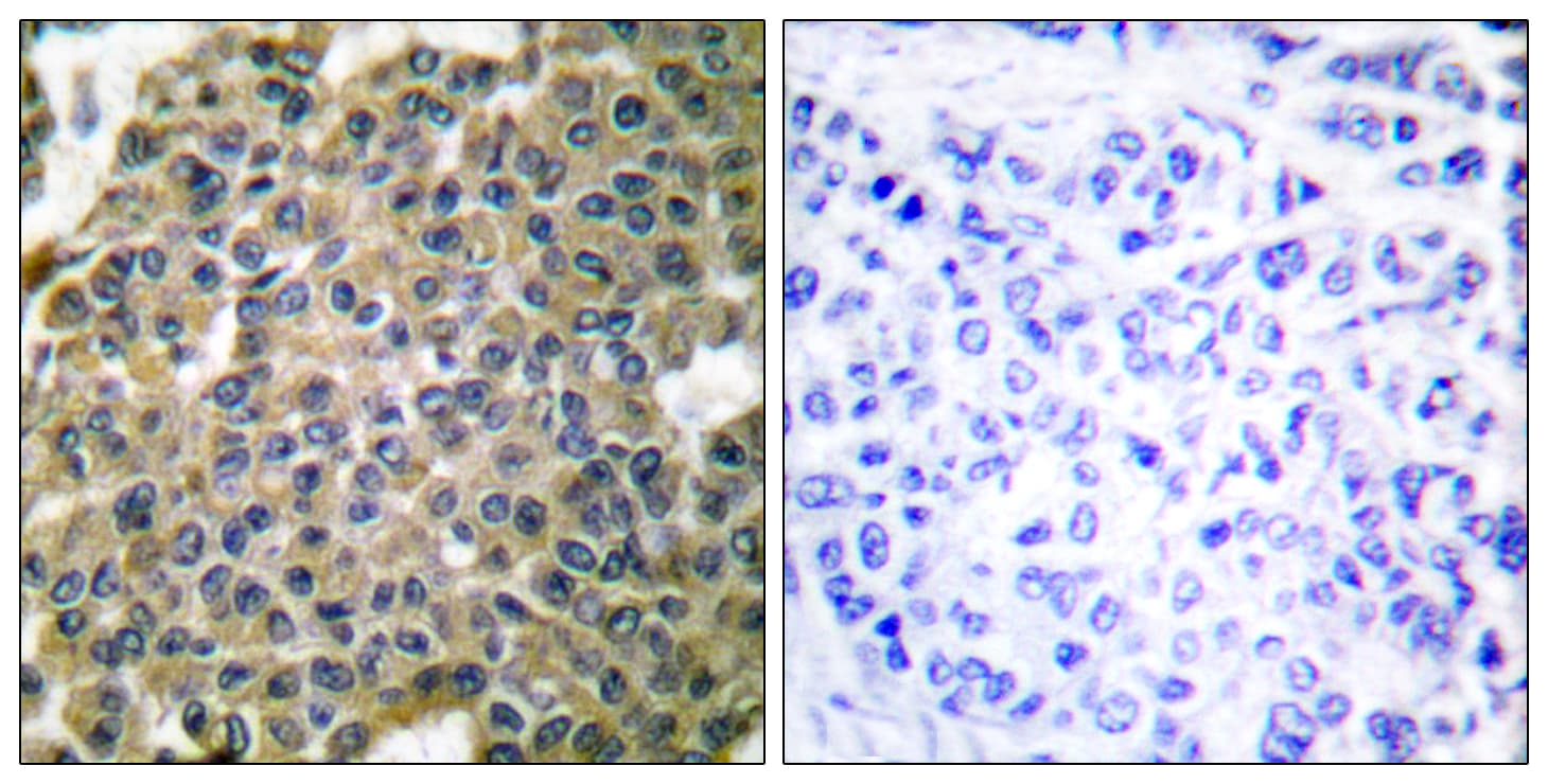 Polyclonal Rabbit anti-Human KRT7 / CK7 / Cytokeratin 7 Antibody (aa420-469, IHC, IF, WB)