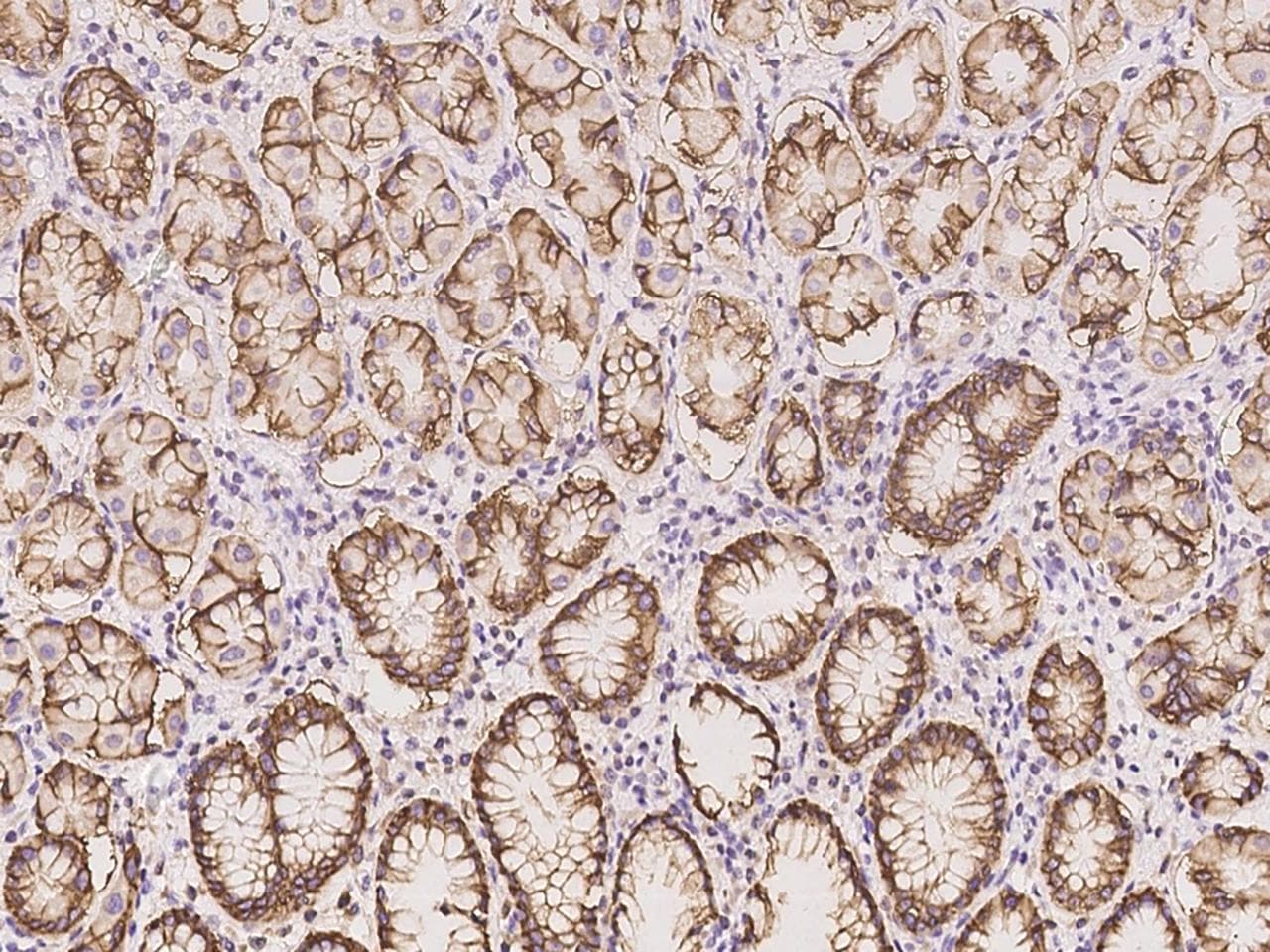 VSIG1 Antibody
