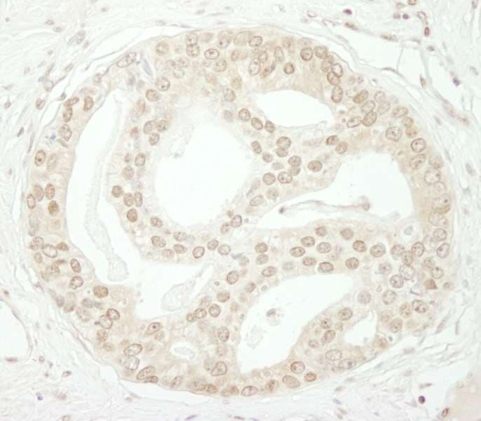 ZBTB40 Antibody (aa1140-1190)