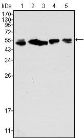 KRT8 / CK8 / Cytokeratin 8 Antibody (Amino Acid: 391-483, clone 8A5D12)
