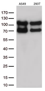 Monoclonal Mouse anti-Human KARS Antibody (clone OTI1E7, IHC, WB)