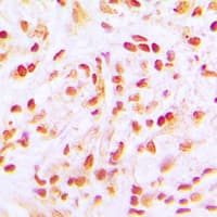 APC6 / CDC16 Antibody (C-Terminus)