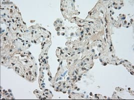 TSC501 / NAT8 Antibody (clone OTI6H3)