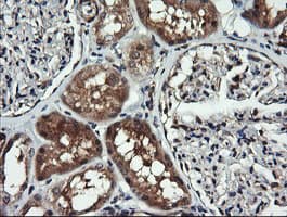 Monoclonal Mouse anti-Human MAP2K1 / MKK1 / MEK1 Antibody (clone OTI1A9, IHC, IF, WB)