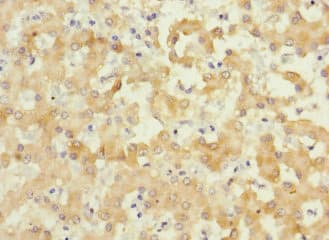 Polyclonal Rabbit anti-Human IL17RB Antibody (IHC)