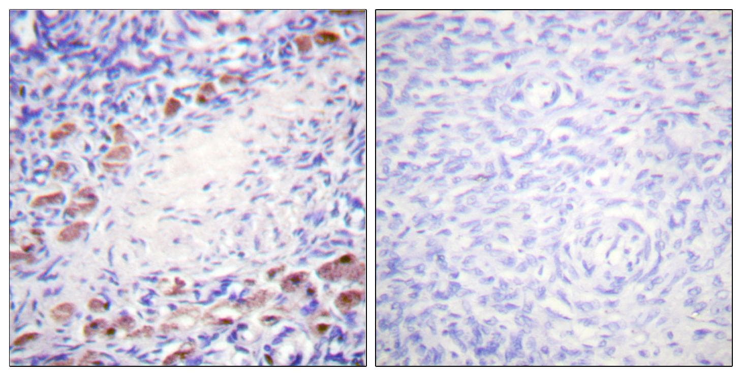 Polyclonal Rabbit anti-Human DAXX Antibody (p668, IHC, WB)