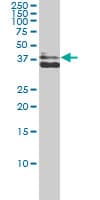 IHC-plus™ AKR1C4 / Chlordecone Reductase Antibody (clone 2C11)