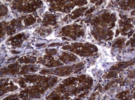 Monoclonal Mouse anti-Human TS / Thymidylate Synthase Antibody (clone 10F12, Carrier-free, IHC, WB)