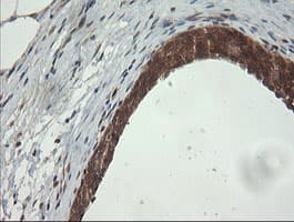 Monoclonal Mouse anti-Human PIK3CG / PI3K Gamma Antibody (clone OTI2B1, IHC, WB)