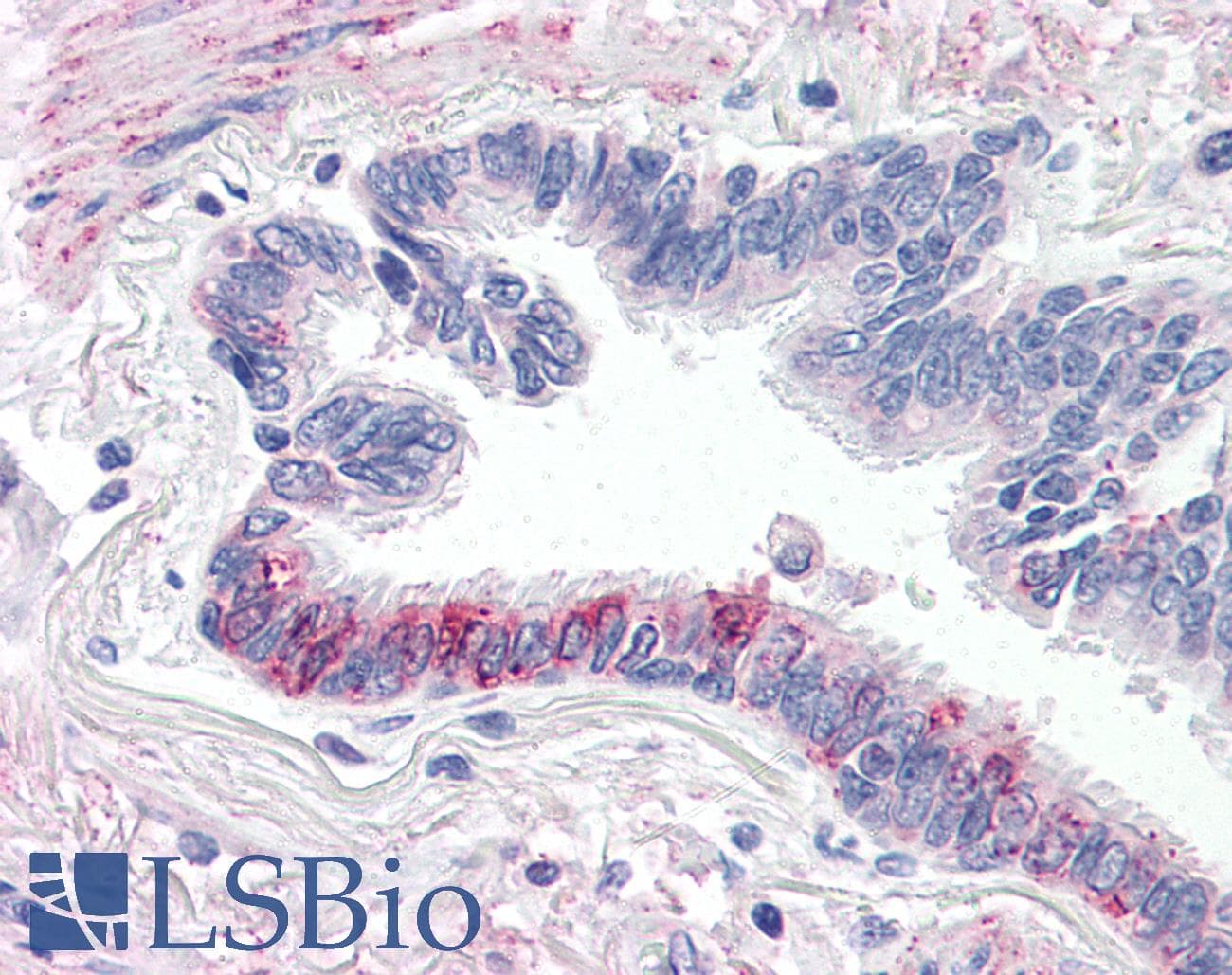 IHC-plus™ Polyclonal Rabbit anti-Human F2RL3 / PAR4 Antibody (C-Terminus, IHC)