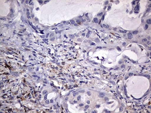 KYNU Antibody (aa1-216, clone OTI5E4)