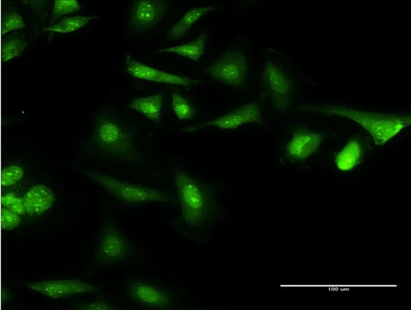 CAMLG / CAML Antibody (clone 3F12)