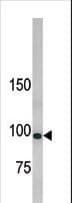 LLGL1 / HUGL Antibody (aa172-205)