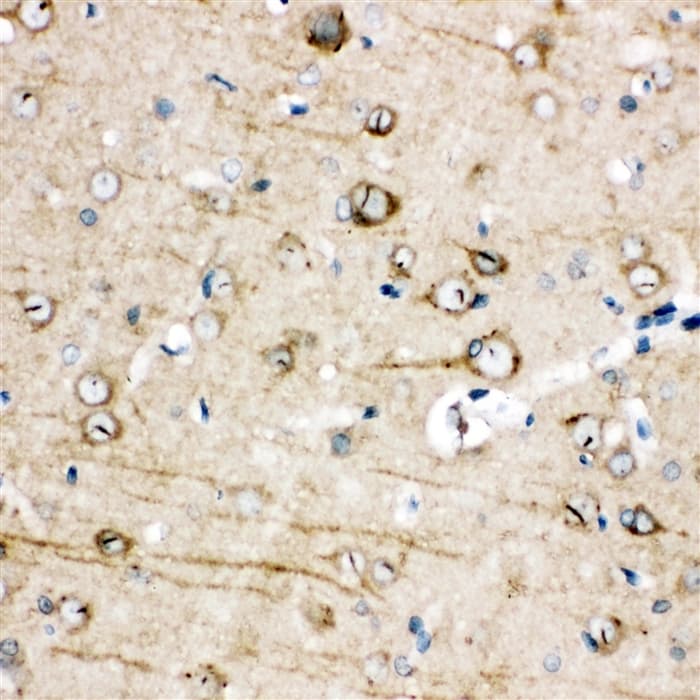 TRPC3 Antibody (aa836-851)