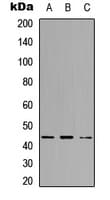Polyclonal Rabbit anti-Human SPT3 / SUPT3H Antibody (Internal, IHC, IF, WB)