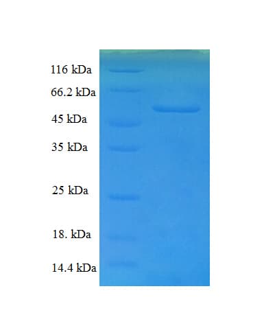Human ERGIC3 Protein (Recombinant His-SUMO)