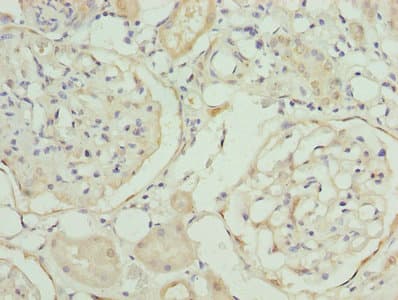 Polyclonal Rabbit anti-Human MAT2A Antibody (IHC)