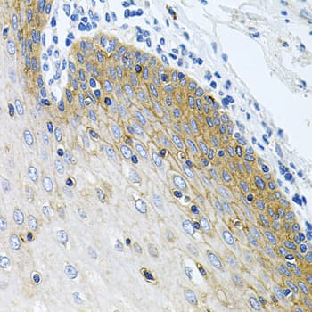 GLCNE / GNE Antibody