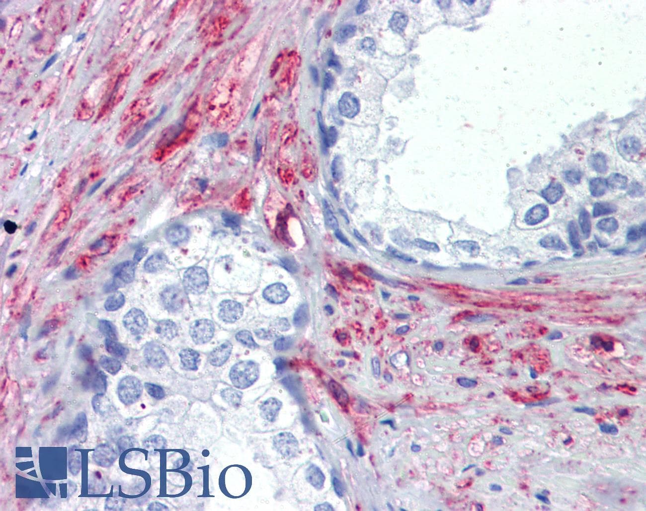 IHC-plus™ PRKG Antibody