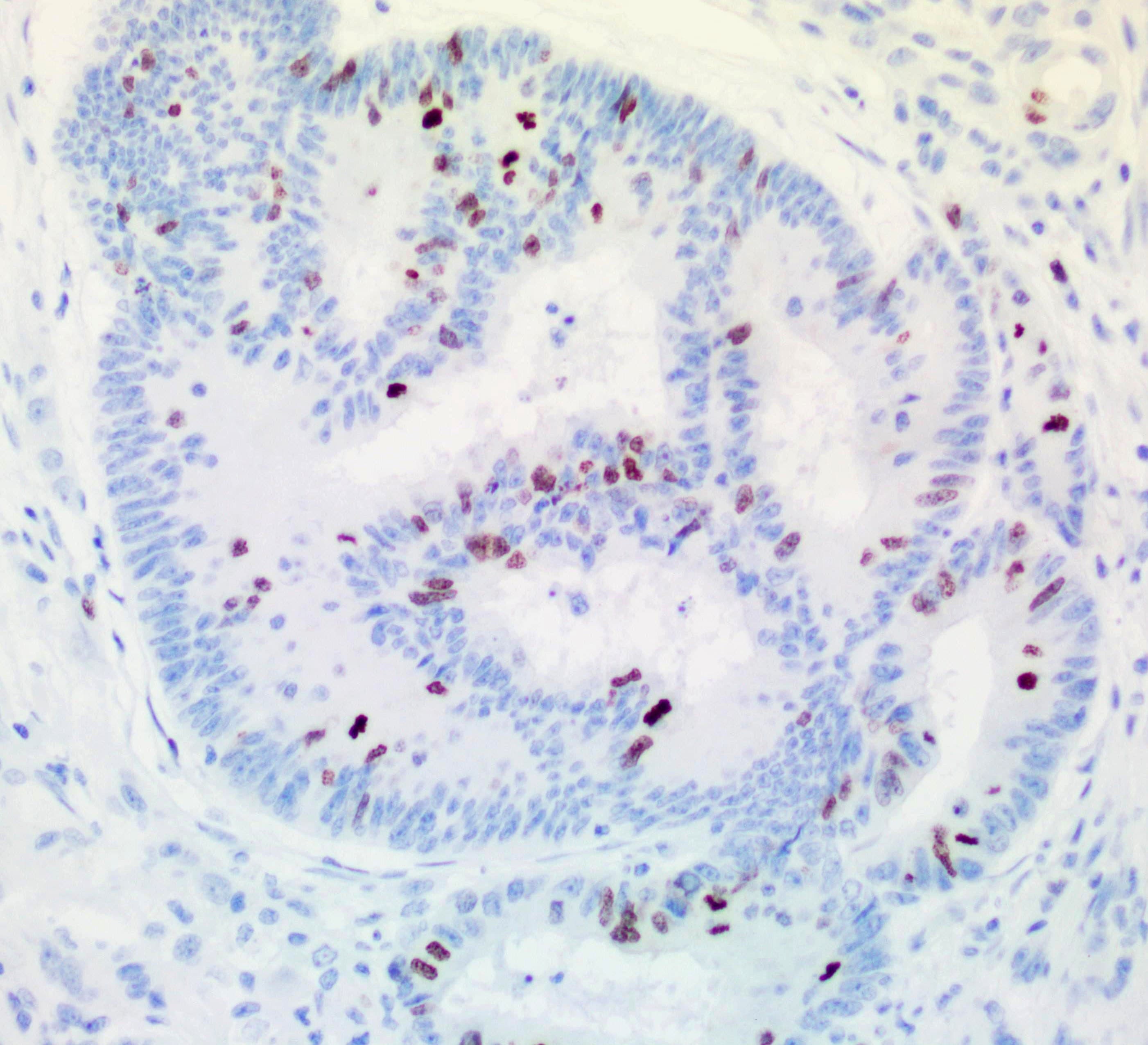 TOP2A / Topoisomerase II Alpha Antibody (aa1100-1531, clone UMAB145, Carrier-free)