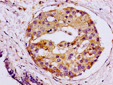 Polyclonal Rabbit anti-Human SNAP23 / SNAP-23 Antibody (IHC)