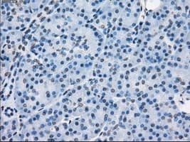 PSMA7 Antibody (clone OTI2A7, Carrier-free)