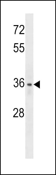 LYVE1 Antibody (aa243-272)