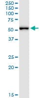 MPP1 Antibody (clone 1E11-1G11)