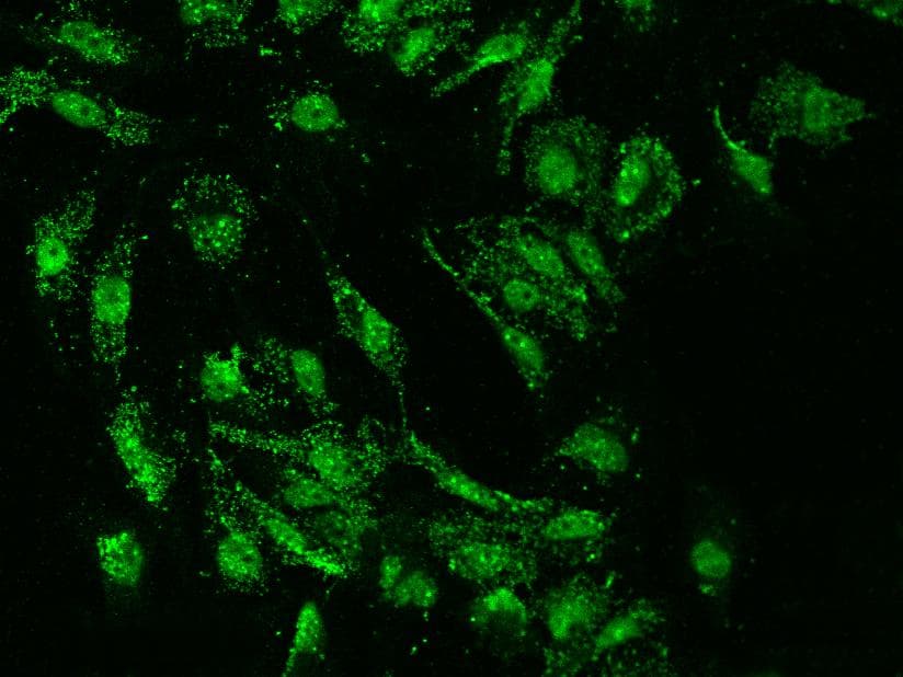 SUMO4 Antibody