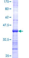 Human PHOSPHO1 Protein (Recombinant GST, N-terminus)