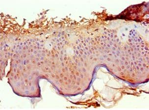 Polyclonal Rabbit anti-Human PTPRA / RPTP-Alpha Antibody (aa20-142, IHC)