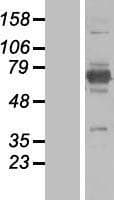 EPM2AIP1 Protein (Over-Expression Lysate Myc-DDK (Flag))