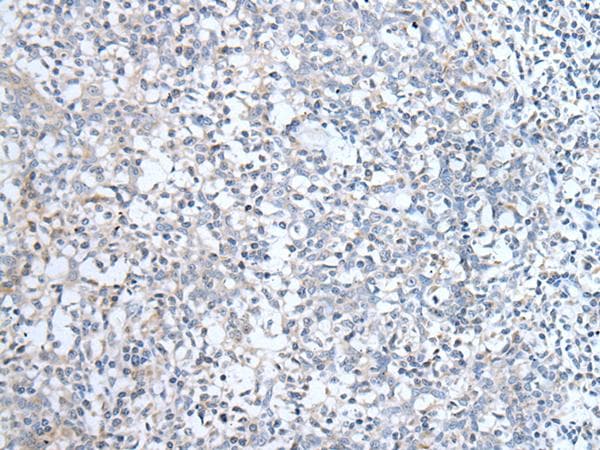 ALDP / ABCD1 Antibody
