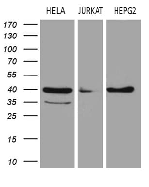 LSM11 Antibody (clone OTI1H1)