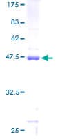 Human MRPS25 Protein (Recombinant GST)