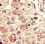STK16 Antibody (aa257-286)