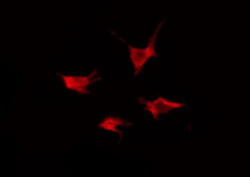 ACVRL1 Antibody