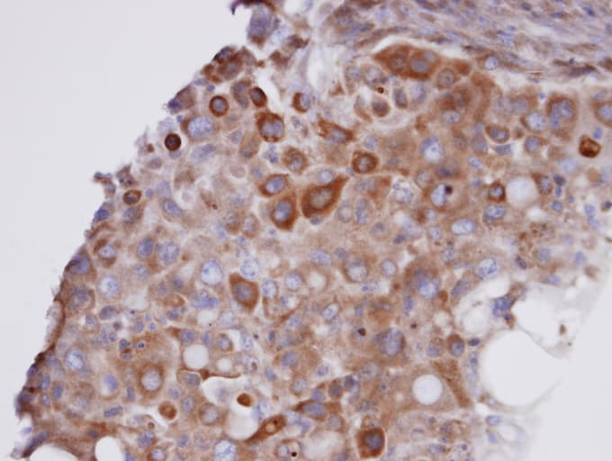 Polyclonal Rabbit anti-Human GPX7 Antibody (aa1-187, IHC, WB)