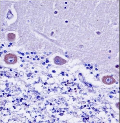 KDELR2 Antibody (aa183-211)