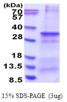Human CNPY4 Protein (Recombinant His)