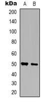 ZNF436 Antibody (Internal)