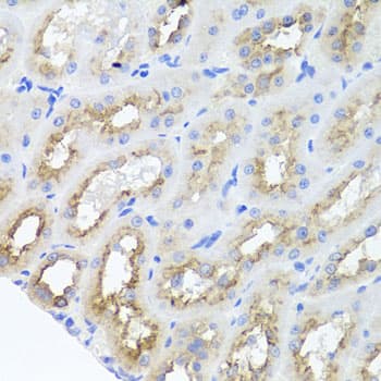 Polyclonal Rabbit anti-Human AMBRA1 Antibody (IHC, WB)